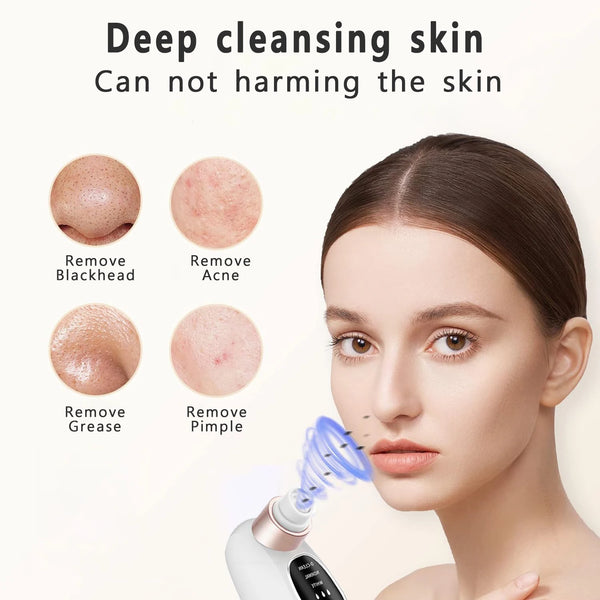 Pore Perfect Blackhead Vacuum