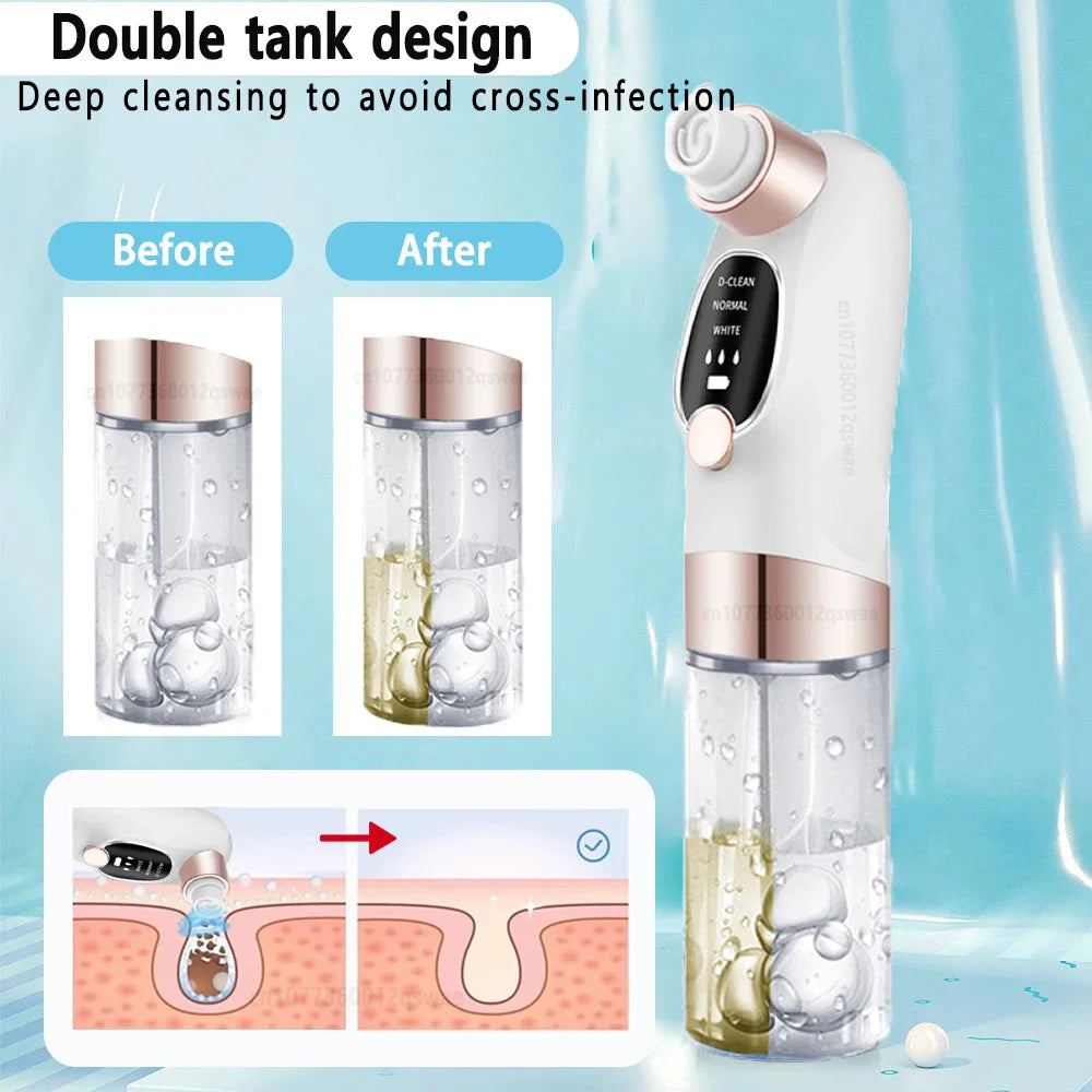 Pore Perfect Blackhead Vacuum