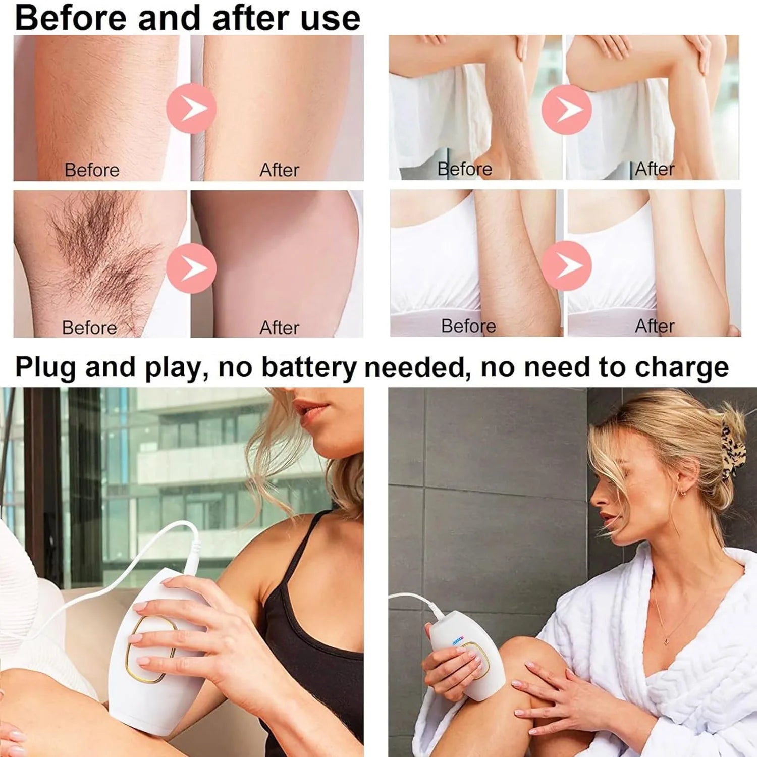 SmoothSkin Home Laser Epilator