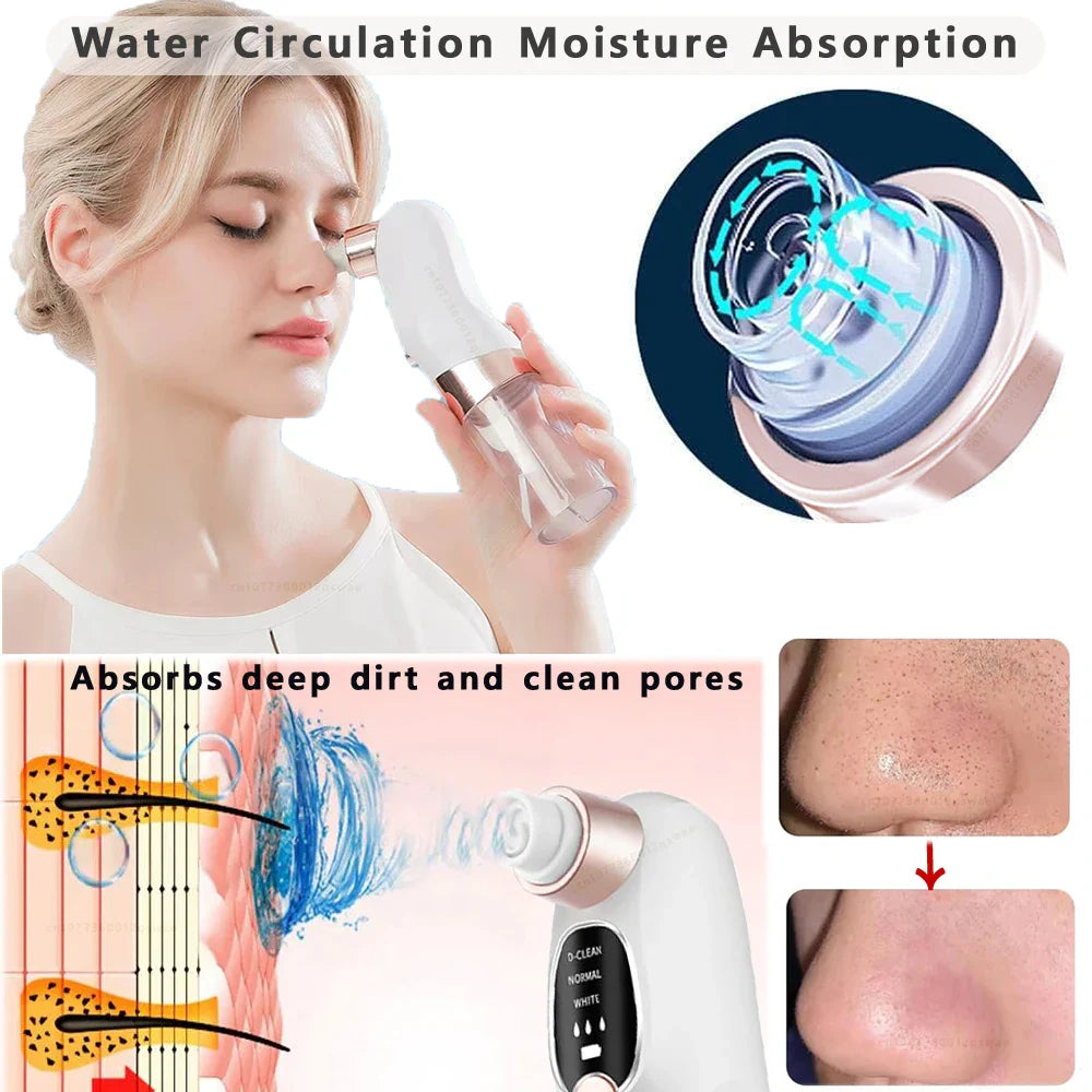 Pore Perfect Blackhead Vacuum